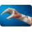 Preformed Functional Position Hand Splint
