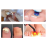 PACT Med Photodynamic Nail Fungus Therapy Kit