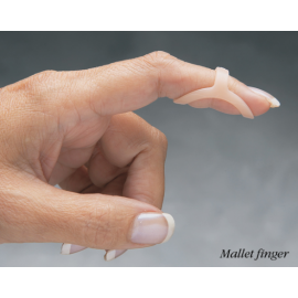 Oval-8 Trigger Finger Splint